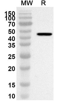 MB Rabbit Polyclonal Antibody