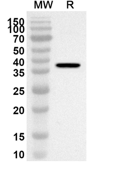 CALU Rabbit Polyclonal Antibody