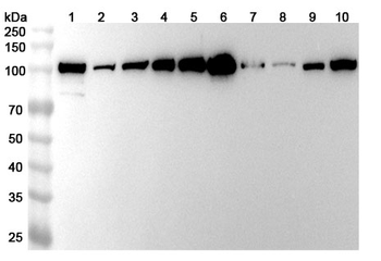 ACTN4 Rabbit Polyclonal Antibody