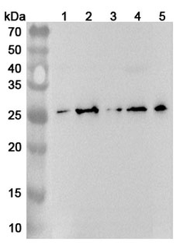 CD254/RANKL/TNFSF11 Rabbit Polyclonal Antibody
