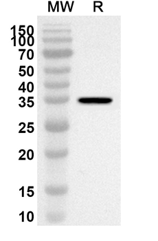 LGALS8 Rabbit Polyclonal Antibody