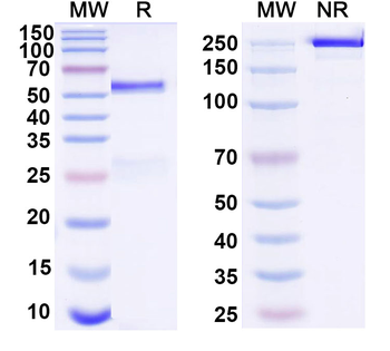 LCN2/NGAL Monoclonal Mouse Monoclonal Antibody