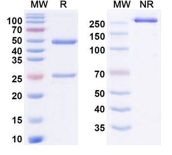 S100B Monoclonal Mouse Monoclonal Antibody
