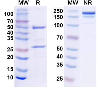 S100B Monoclonal Mouse Monoclonal Antibody
