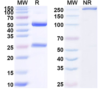 AFP/Alpha-fetoprotein Monoclonal Mouse Monoclonal Antibody