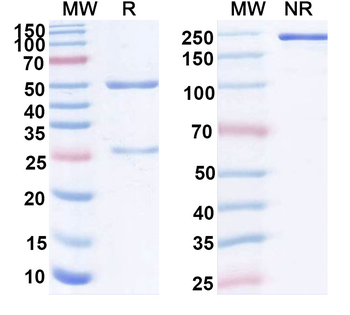 Hendra virus/HeV Glycoprotein G Monoclonal Mouse Monoclonal Antibody