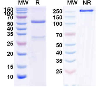 IL18/IL1F4 Monoclonal Mouse Monoclonal Antibody
