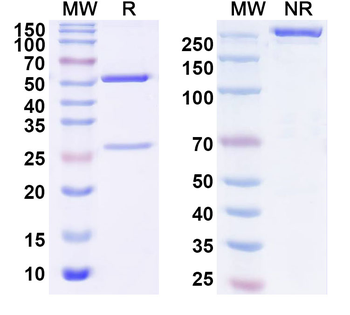 NEU1/Sialidase-1 Monoclonal Mouse Monoclonal Antibody