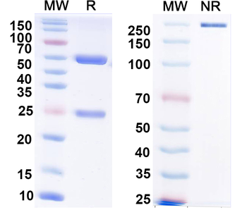 IGFBP1 Monoclonal Mouse Monoclonal Antibody