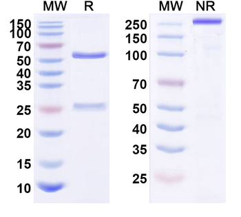 GOLM1/GP73 Monoclonal Mouse Monoclonal Antibody