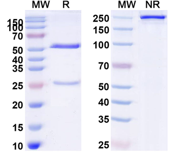GOLM1/GP73 Monoclonal Mouse Monoclonal Antibody
