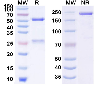 POSTN/OSF-2 Monoclonal Mouse Monoclonal Antibody