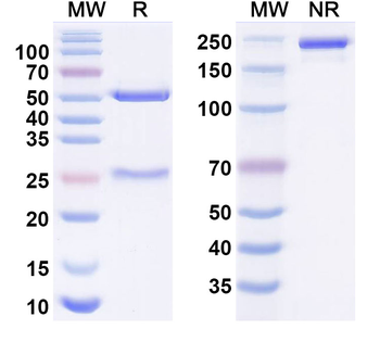 NEU1/Sialidase-1 Mouse Monoclonal Antibody