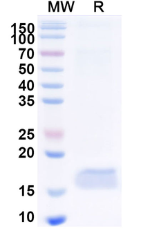 Oropouche virus/OROV Glycoprotein G1 Nanobody Camelus Monoclonal Antibody
