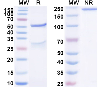 ASF1B IP Mouse Monoclonal Antibody
