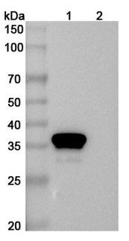 CD81 Human Monoclonal Antibody