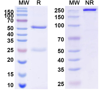 CXCL4/PF4 Mouse Monoclonal Antibody