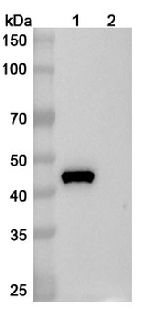 Gal d 2 IgE Human Recombinant Antibody