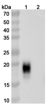 CH1/CH2/Allergen Fel d I-A/B Human Monoclonal Antibody