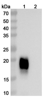 CH1/CH2/Allergen Fel d I-A/B Human Monoclonal Antibody