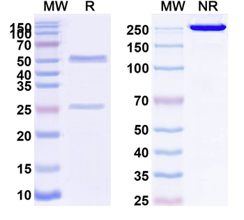 SARS-CoV NP/Nucleoprotein Human Monoclonal Antibody
