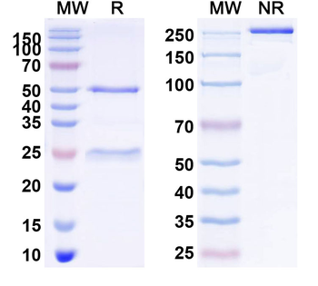 SARS-CoV-2 NP/Nucleoprotein Human Monoclonal Antibody