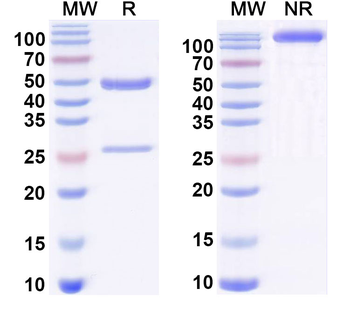 SLC2A5 Mouse Monoclonal Antibody