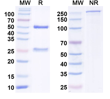 Helicobacter pylori ureA/Urease subunit alpha Mouse Monoclonal Antibody