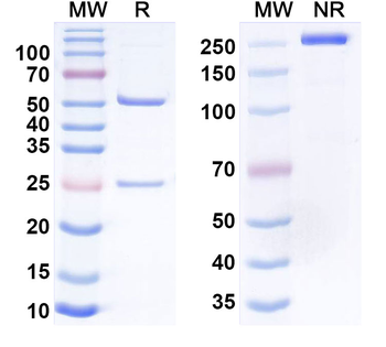 Helicobacter pylori ureB/Urease subunit beta Mouse Monoclonal Antibody