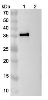 IL11 Mouse Monoclonal Antibody