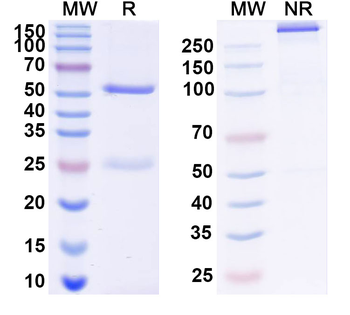RAGE/AGER Mouse Monoclonal Antibody