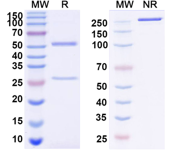 RAGE/AGER Mouse Monoclonal Antibody
