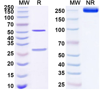 CD360/IL21R Human Monoclonal Antibody