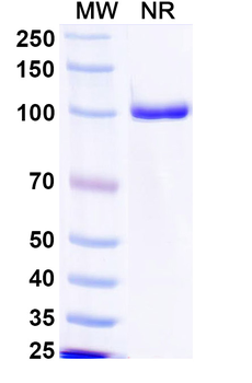 Norovirus/Norwalk virus Capsid protein VP1/p59 Human Monoclonal Antibody
