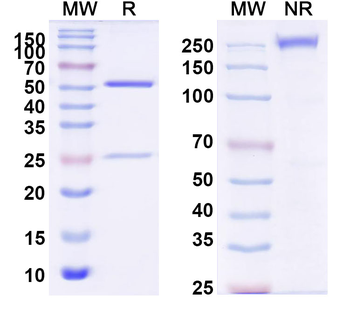 DENV-4 Envelope protein E/EDIII domain Human Monoclonal Antibody