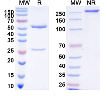 DENV-1 Envelope protein E/EDIII domain Human Monoclonal Antibody
