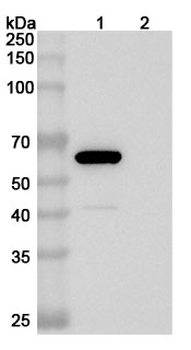 Clostridium perfringens pfo/Perfringolysin O/Theta-toxin Mouse Monoclonal Antibody
