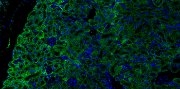 PINK1 Mouse Monoclonal Antibody