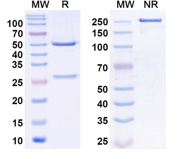 SLC13A5/NaCT Mouse Monoclonal Antibody