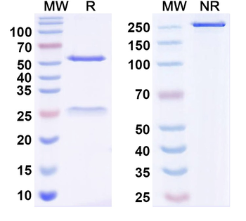 TrkB Mouse Monoclonal Antibody
