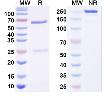 Kvbeta K+ channel/Pan-Kvbeta K+ channel Mouse Monoclonal Antibody