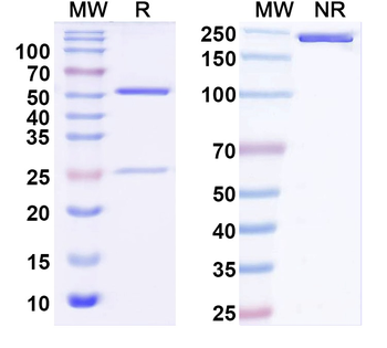 Kir2.2 K+ channel Mouse Monoclonal Antibody