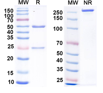 Calretinin Mouse Monoclonal Antibody