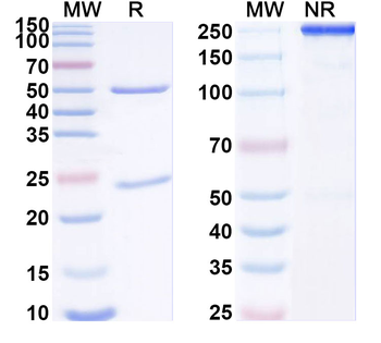 TASK1 K+ channel Mouse Monoclonal Antibody