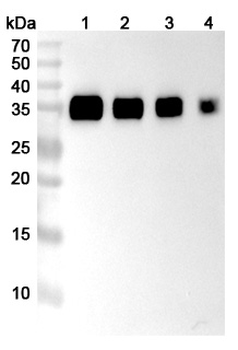 CD274/PD-L1/B7-H1 Human Monoclonal Antibody