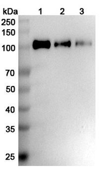 CD56/NCAM1 Human Monoclonal Antibody