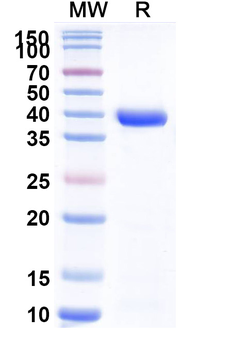 Neisseria meningitidis NadA/Neisseria adhesin A Human Monoclonal Antibody
