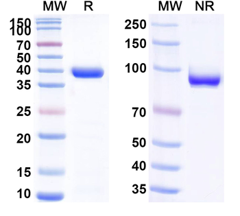 Neisseria meningitidis NadA/Neisseria adhesin A Human Monoclonal Antibody