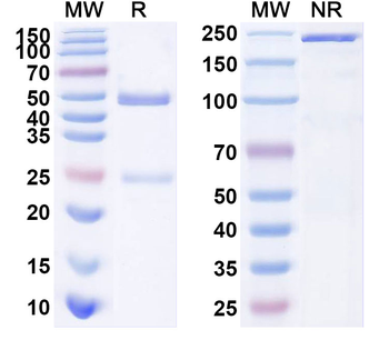 Neisseria meningitidis porA/Outer membrane porin protein Human Monoclonal Antibody