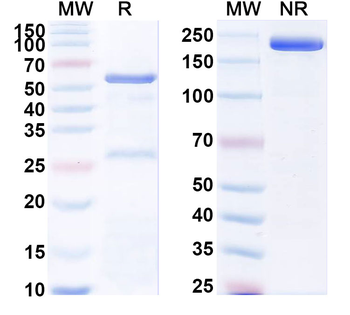 PLA2R1/PLA2R Mouse Monoclonal Antibody